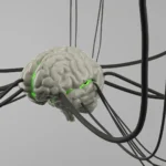 3D rendering of a human brain wired to multiple electrodes, illustrating deep brain stimulation of neural circuits