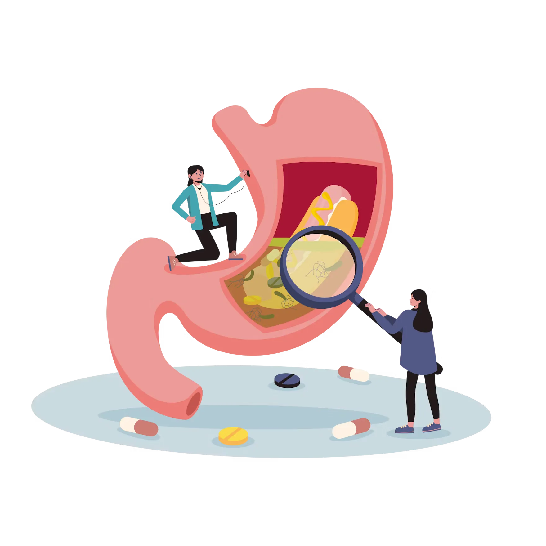 A medical vector illustration of practitioners examining a stomach, representing the complex gut-brain axis connection behind stress and digestive issues.