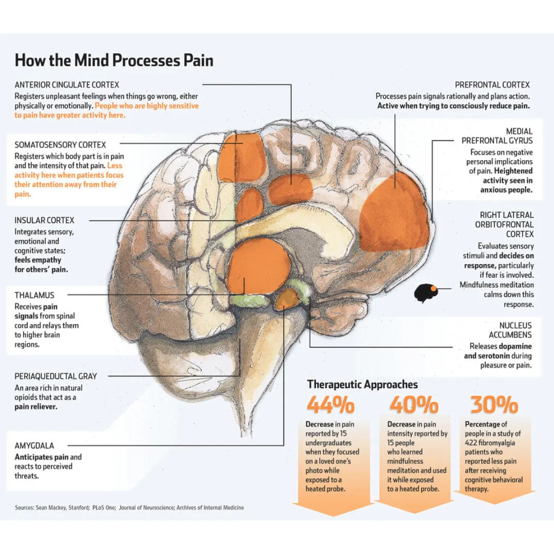 An infographic titled "How the Mind Processes Pain" showing a diagram of the human brain with highlighted regions like the Anterior Cingulate Cortex, Somatosensory Cortex, and Amygdala, along with descriptions of their role in pain perception and therapeutic approaches statistics.