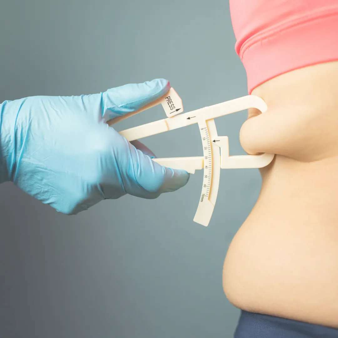 A healthcare professional wearing blue gloves using calipers to measure subcutaneous body fat.
