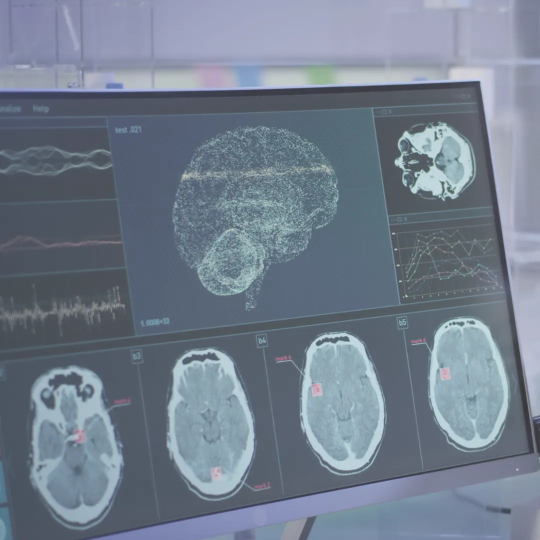 Futuristic medical display screen showing brain scan data and neurological analysis, illustrating the brain-heart connection.